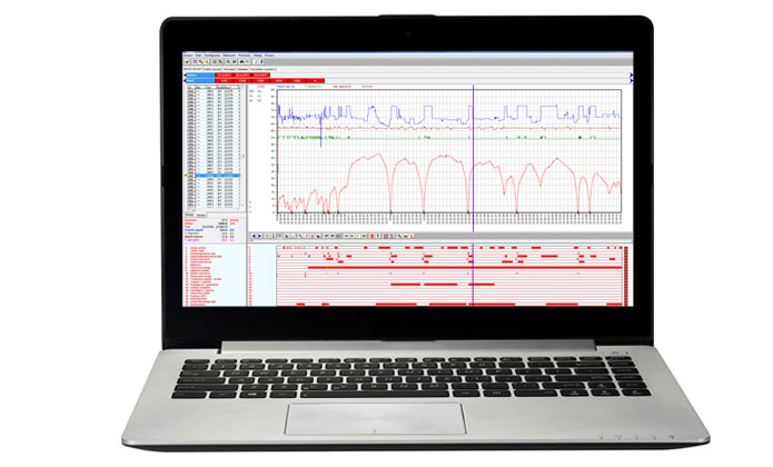 Tachograph data analysis